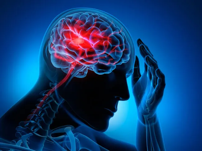 Neurologia